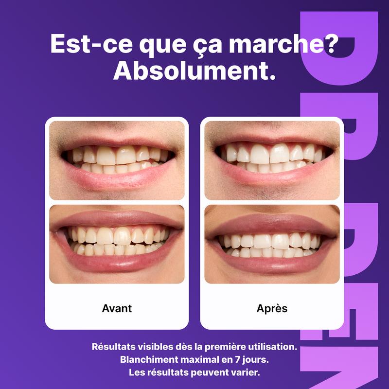 Bande blanchissant dentaire