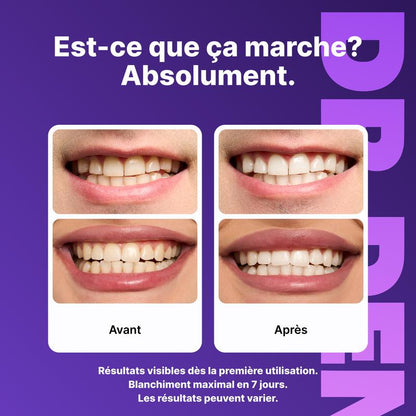 Bande blanchissant dentaire